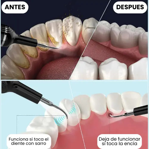 Dentlax™: Tu sonrisa, libre de sarro, manchas y mal aliento.