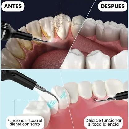 Dentlax™: Tu sonrisa, libre de sarro, manchas y mal aliento.